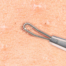 Load image into Gallery viewer, Double Loop Blackhead Remover Pimple Extractor