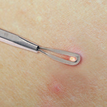 Load image into Gallery viewer, Double Loop Blackhead Remover Pimple Extractor