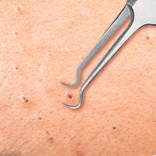 Load image into Gallery viewer, Bend Curved Blackhead Remover Pimple Blemish Extractor